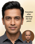Los Angeles Men Hair Patch