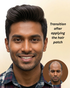 Men Hair Patch – Australian Premium Quality